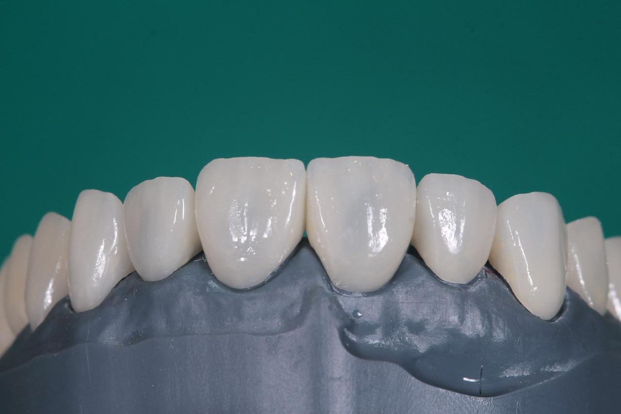 Planejamento digital do sorriso